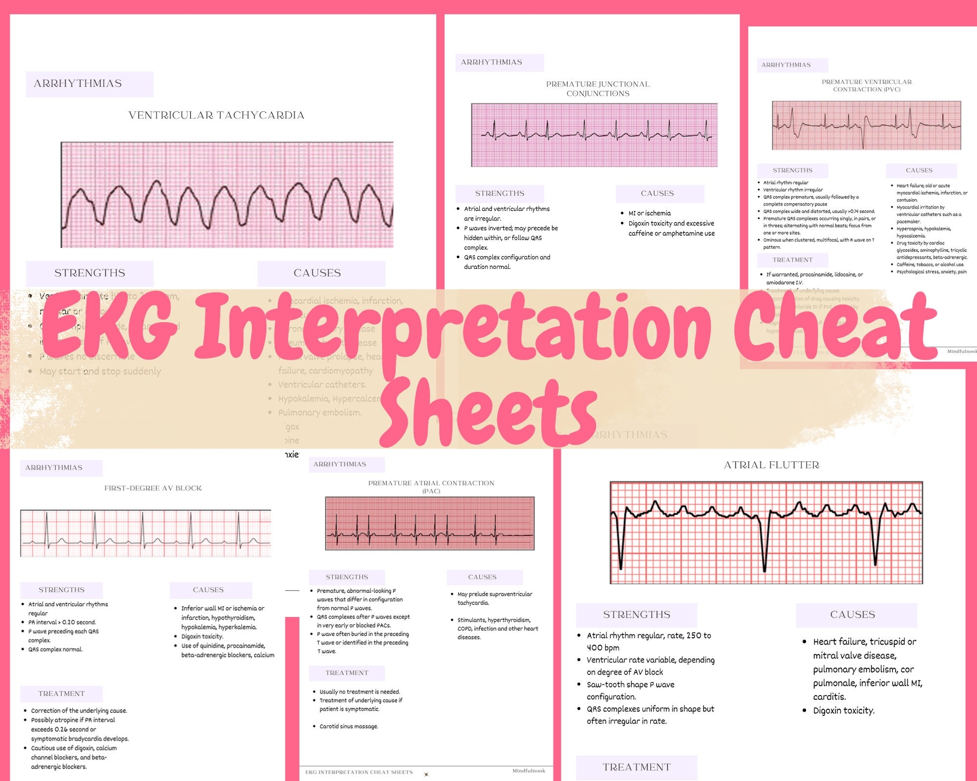 EKG Interpretation Cheat Sheet Free Download Ekg 49 OFF