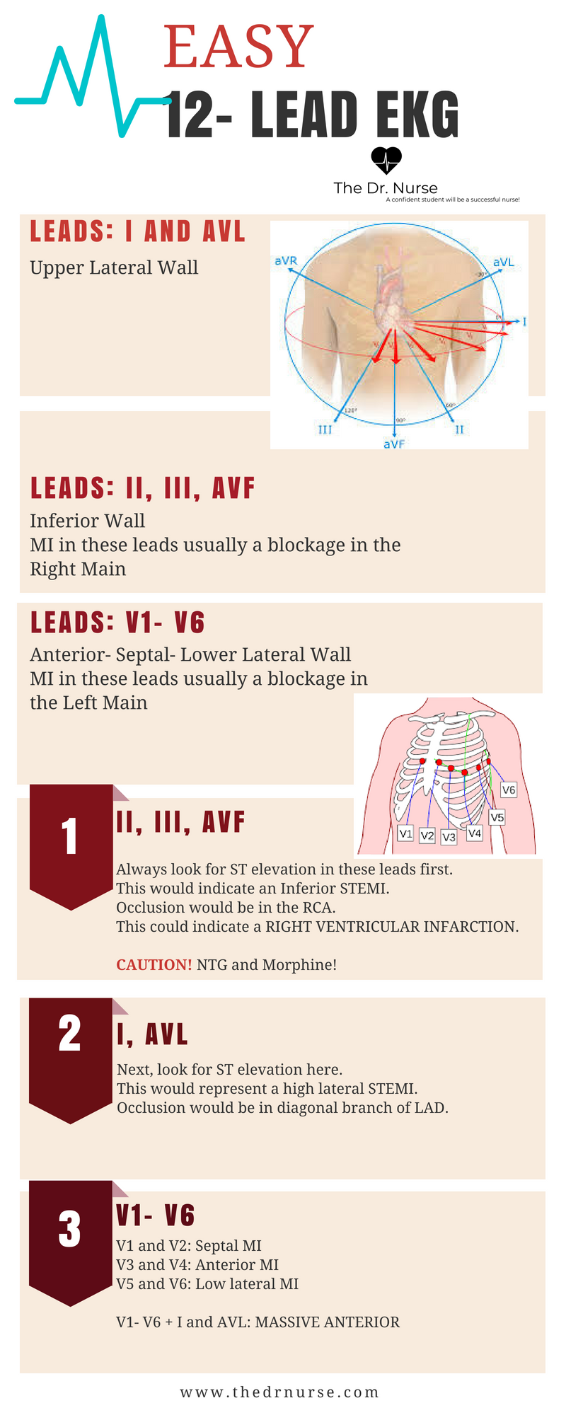 Printable 12 Lead Ekg Interpretation Cheat Sheet Pixilateddesign